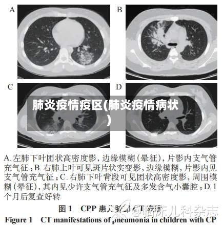肺炎疫情疫区(肺炎疫情病状)-第2张图片